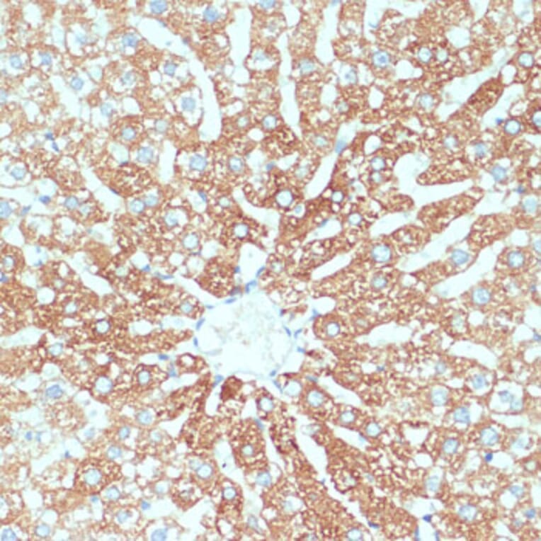 Immunohistochemistry - Anti-ZIP-4 Antibody (A11649) - Antibodies.com