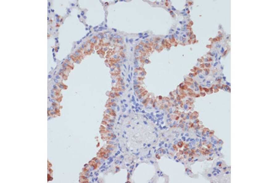 Immunohistochemistry - Anti-ZIP-4 Antibody (A11649) - Antibodies.com