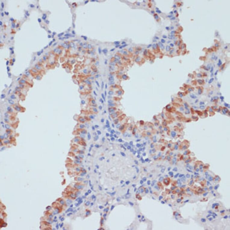 Immunohistochemistry - Anti-ZIP-4 Antibody (A11649) - Antibodies.com