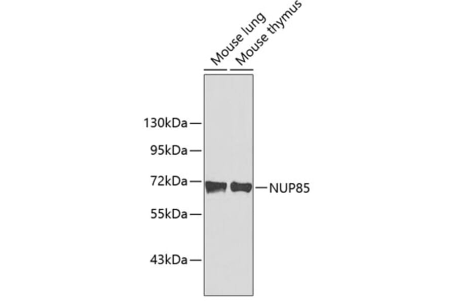 Western Blot - Anti-NUP85 Antibody (A3504) - Antibodies.com