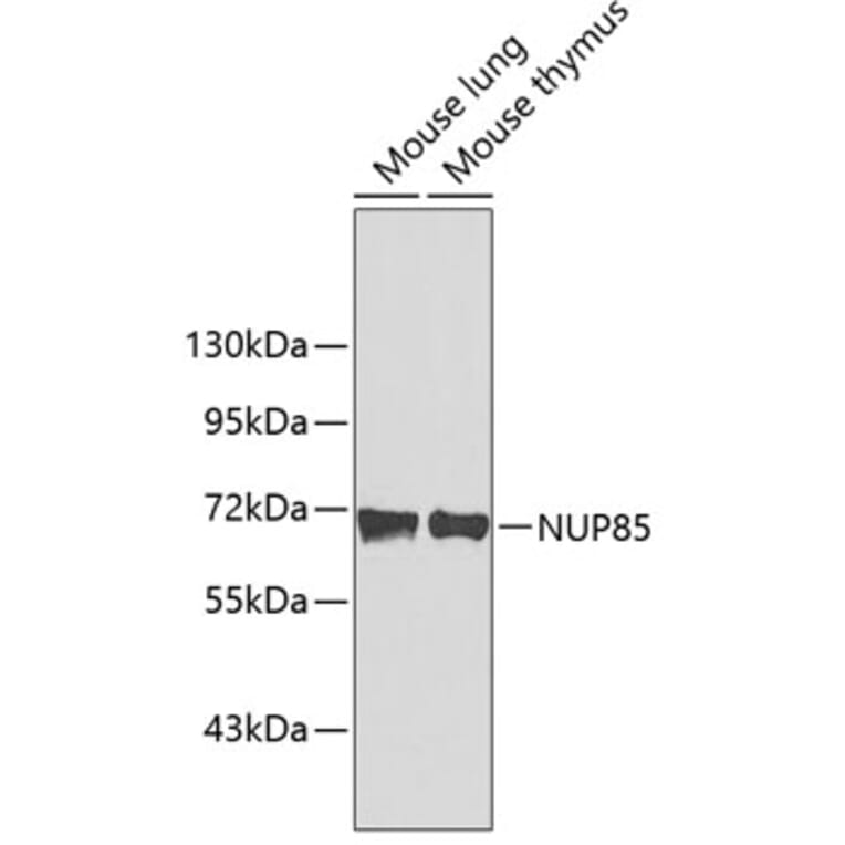 Western Blot - Anti-NUP85 Antibody (A3504) - Antibodies.com