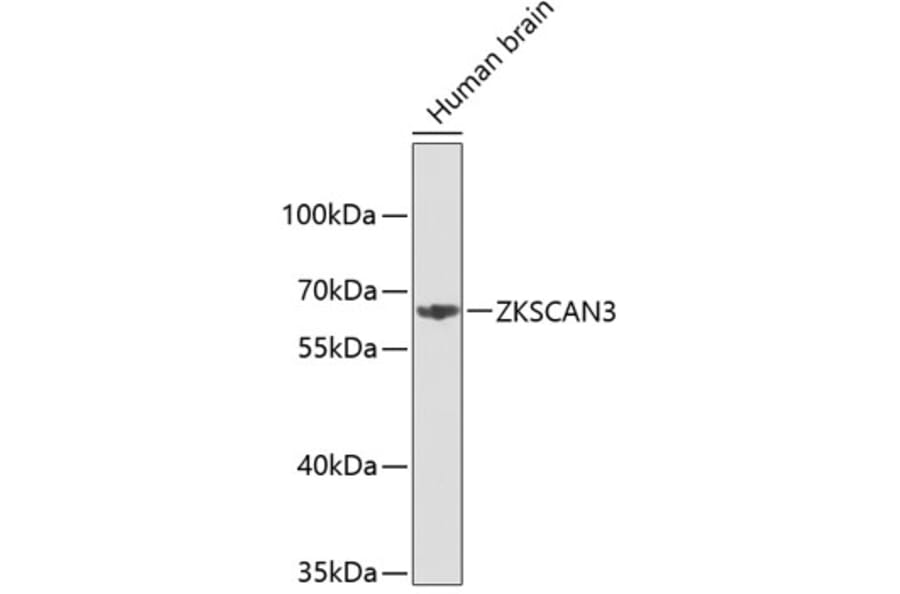 Western Blot - Anti-ZKSCAN3 Antibody (A3514) - Antibodies.com