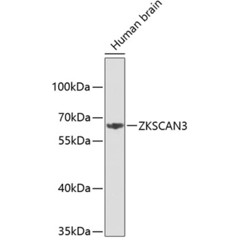 Western Blot - Anti-ZKSCAN3 Antibody (A3514) - Antibodies.com
