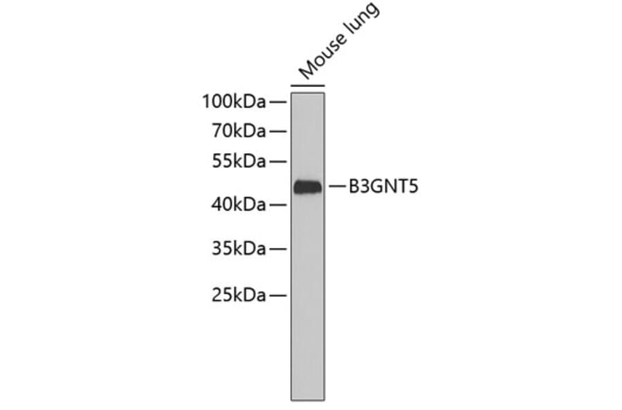 Western Blot - Anti-B3GNT5 Antibody (A3520) - Antibodies.com