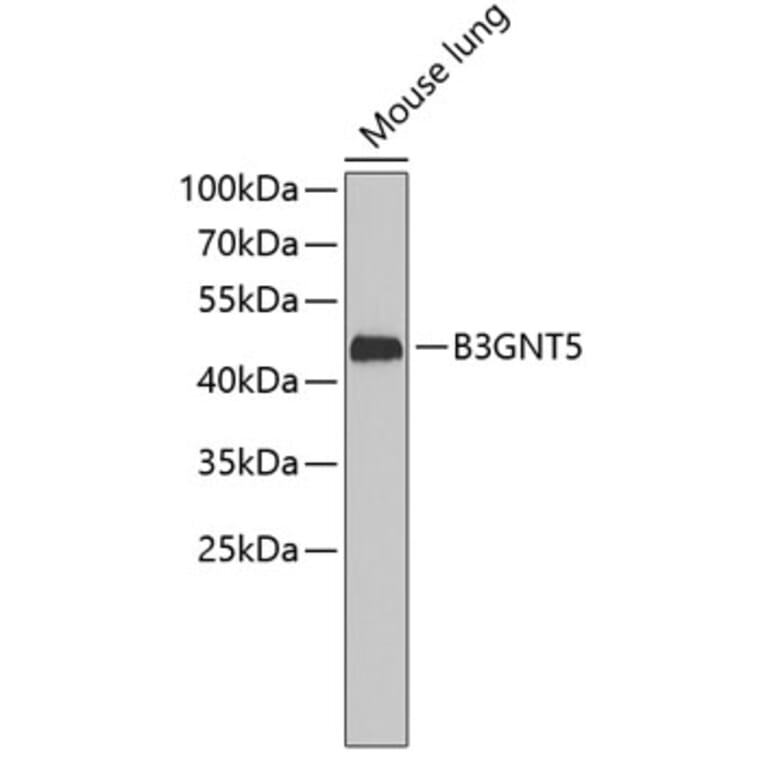 Western Blot - Anti-B3GNT5 Antibody (A3520) - Antibodies.com