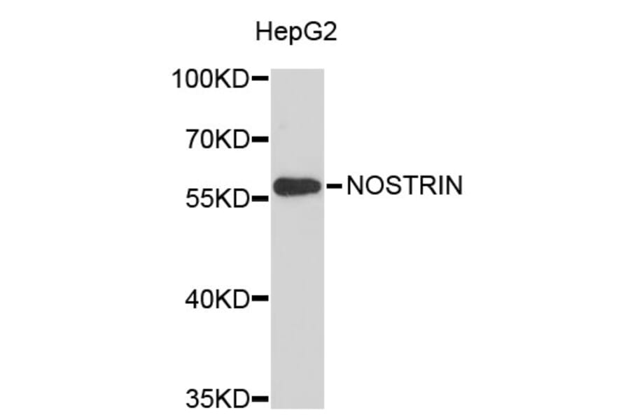 Western Blot - Anti-NOSTRIN Antibody (A3541) - Antibodies.com