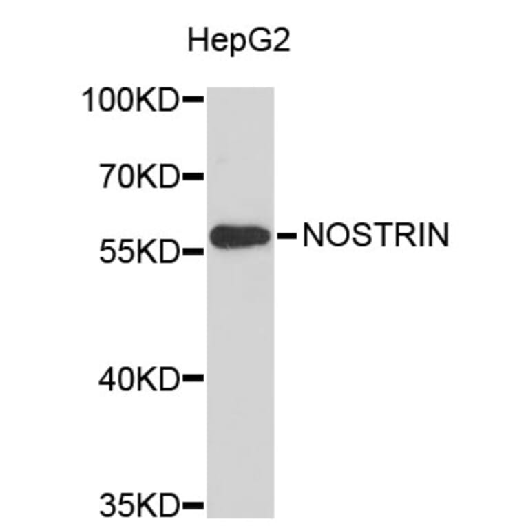 Western Blot - Anti-NOSTRIN Antibody (A3541) - Antibodies.com