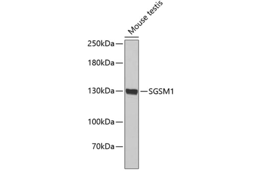 Western Blot - Anti-SGSM1 Antibody (A3544) - Antibodies.com