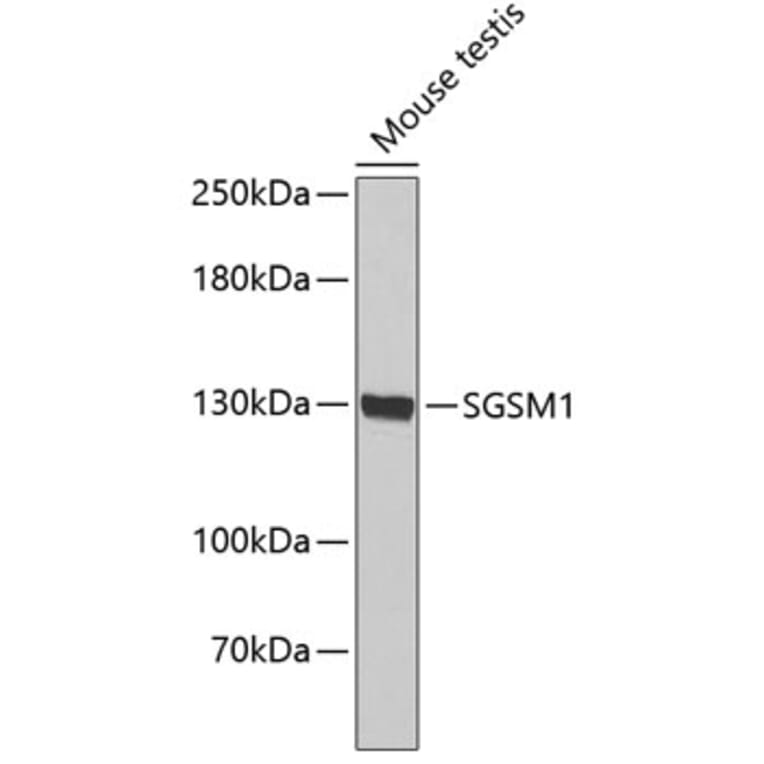 Western Blot - Anti-SGSM1 Antibody (A3544) - Antibodies.com