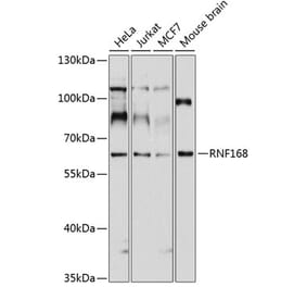 Western Blot - Anti-RNF168 Antibody (A11657) - Antibodies.com