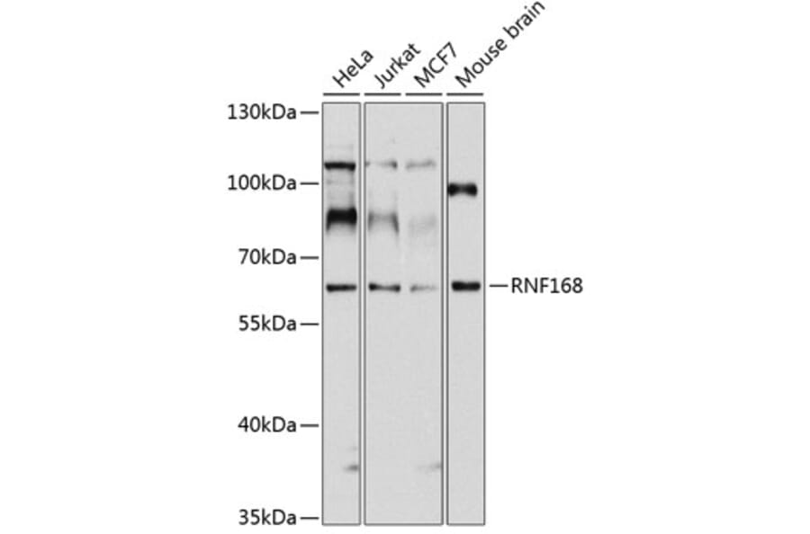 Western Blot - Anti-RNF168 Antibody (A11657) - Antibodies.com