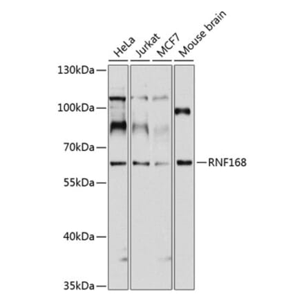 Western Blot - Anti-RNF168 Antibody (A11657) - Antibodies.com