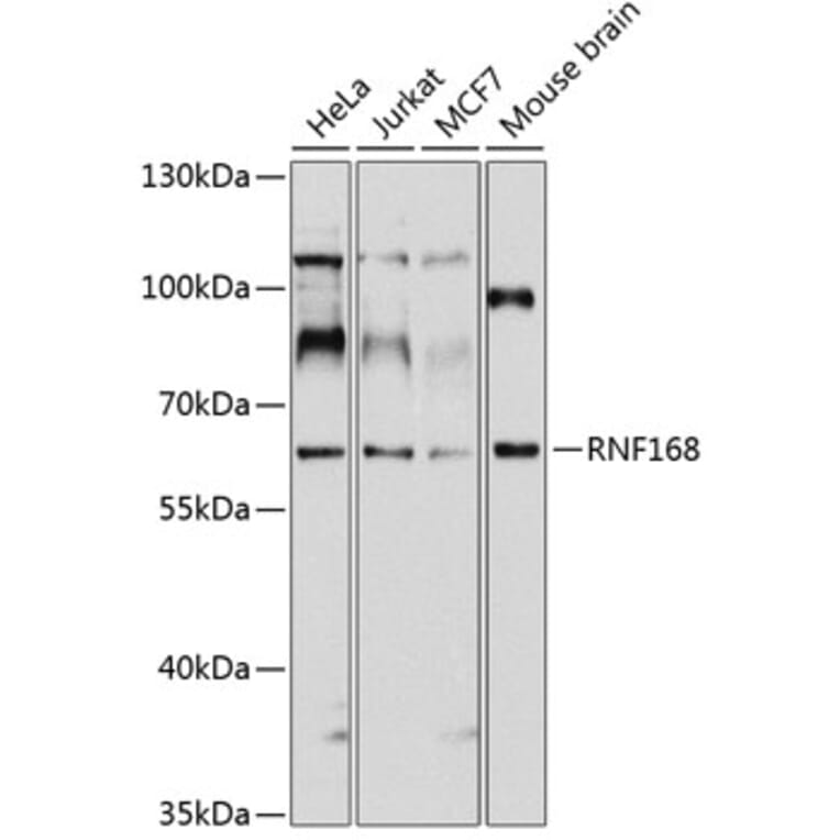 Western Blot - Anti-RNF168 Antibody (A11657) - Antibodies.com