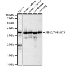 Western Blot - Anti-STING Antibody (A11658) - Antibodies.com