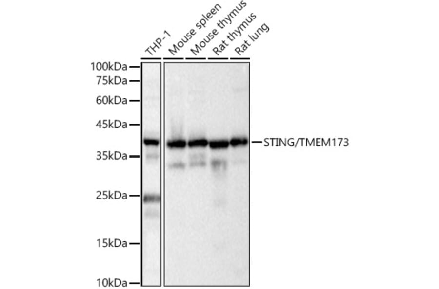 Western Blot - Anti-STING Antibody (A11658) - Antibodies.com