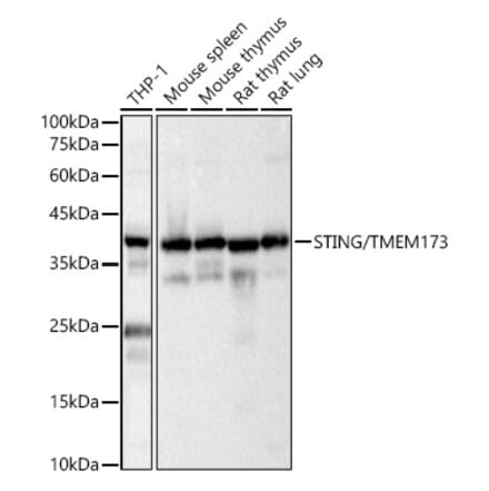 Western Blot - Anti-STING Antibody (A11658) - Antibodies.com