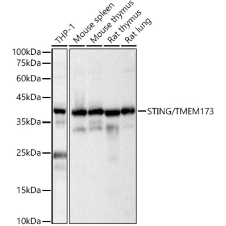 Western Blot - Anti-STING Antibody (A11658) - Antibodies.com