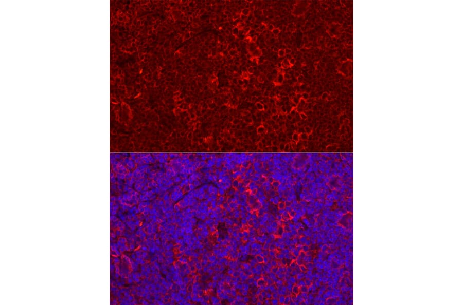 Immunofluorescence - Anti-STING Antibody (A11658) - Antibodies.com
