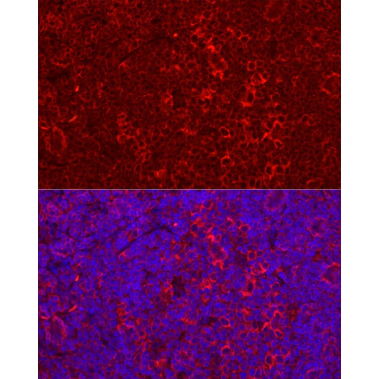 Immunofluorescence - Anti-STING Antibody (A11658) - Antibodies.com