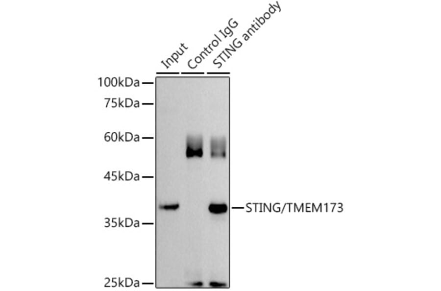 Immunoprecipitation - Anti-STING Antibody (A11658) - Antibodies.com