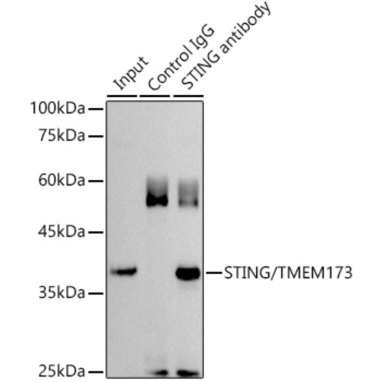 Immunoprecipitation - Anti-STING Antibody (A11658) - Antibodies.com