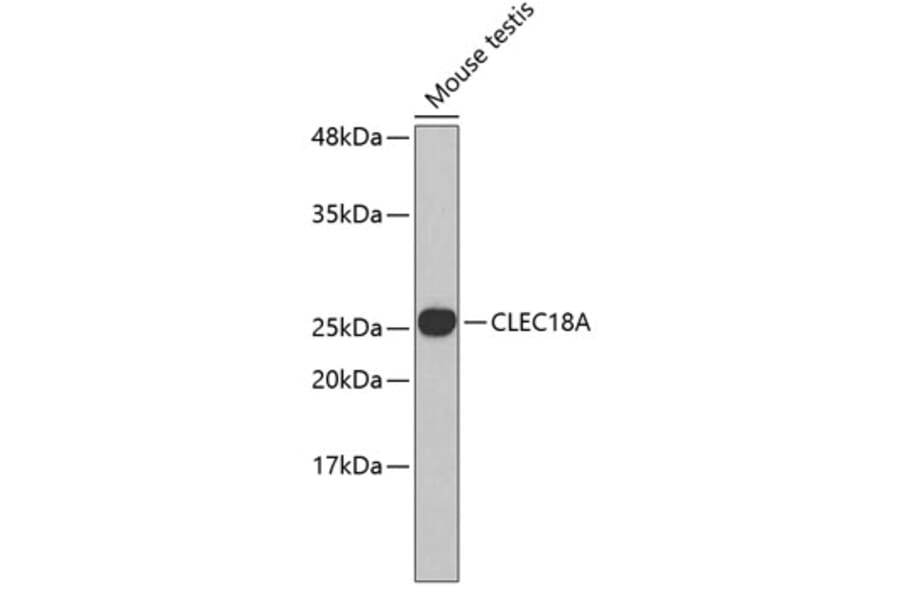 Western Blot - Anti-CLEC18A Antibody (A3578) - Antibodies.com
