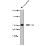 Western Blot - Anti-CLEC18A Antibody (A3578) - Antibodies.com