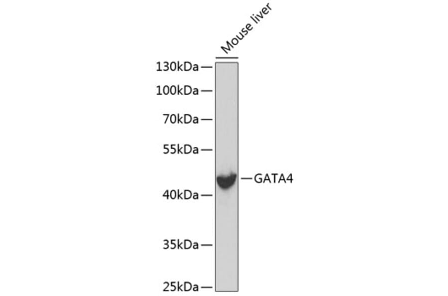 Western Blot - Anti-GATA4 Antibody (A3600) - Antibodies.com