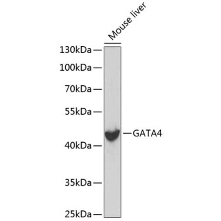 Western Blot - Anti-GATA4 Antibody (A3600) - Antibodies.com
