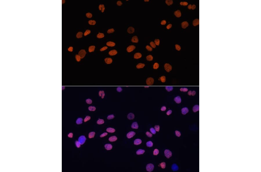 Immunofluorescence - Anti-GATA4 Antibody (A3600) - Antibodies.com