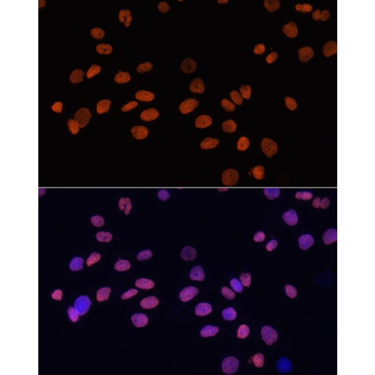 Immunofluorescence - Anti-GATA4 Antibody (A3600) - Antibodies.com