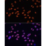 Immunofluorescence - Anti-GATA4 Antibody (A3600) - Antibodies.com