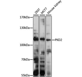 Western Blot - Anti-Polycystin 2 Antibody (A11662) - Antibodies.com