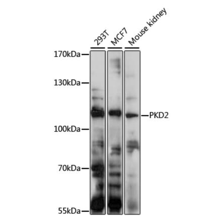 Western Blot - Anti-Polycystin 2 Antibody (A11662) - Antibodies.com