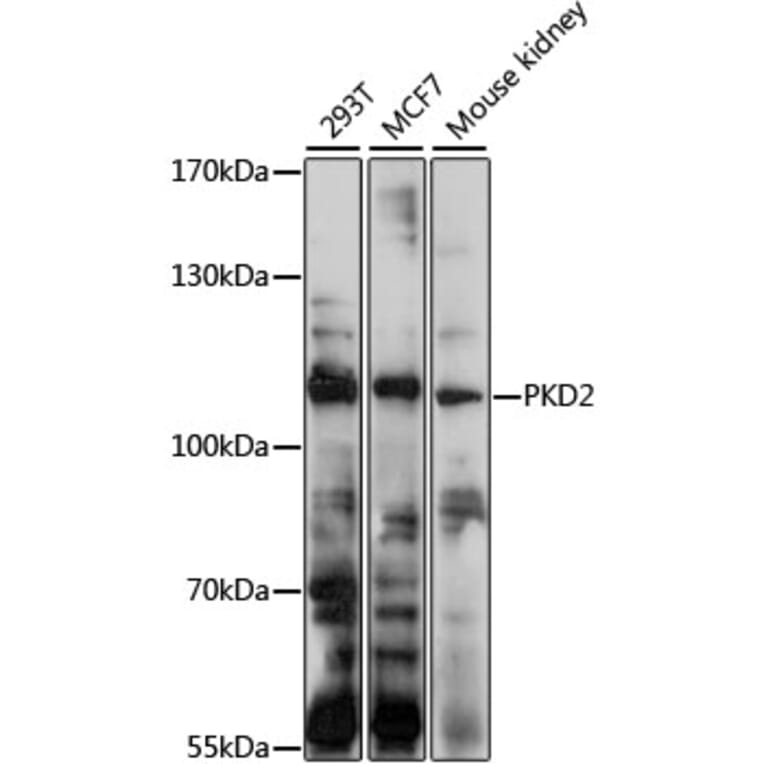 Western Blot - Anti-Polycystin 2 Antibody (A11662) - Antibodies.com