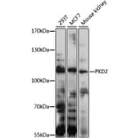 Western Blot - Anti-Polycystin 2 Antibody (A11662) - Antibodies.com