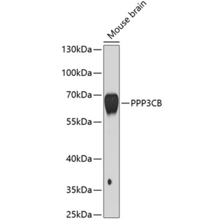 Western Blot - Anti-PPP3CB Antibody (A3629) - Antibodies.com