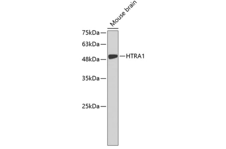 Western Blot - Anti-HTRA1 Antibody (A3631) - Antibodies.com