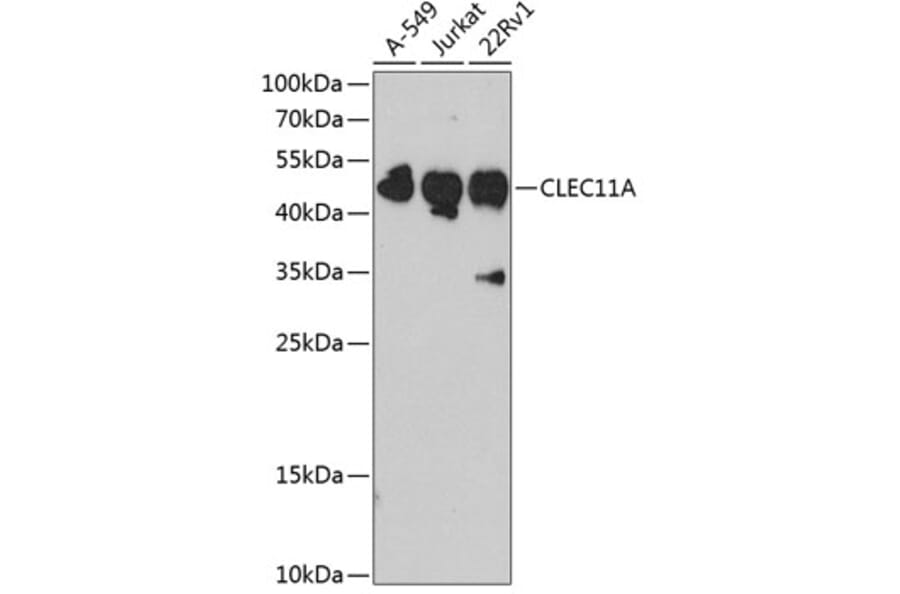Western Blot - Anti-SCGF Antibody (A11666) - Antibodies.com