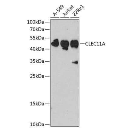 Western Blot - Anti-SCGF Antibody (A11666) - Antibodies.com