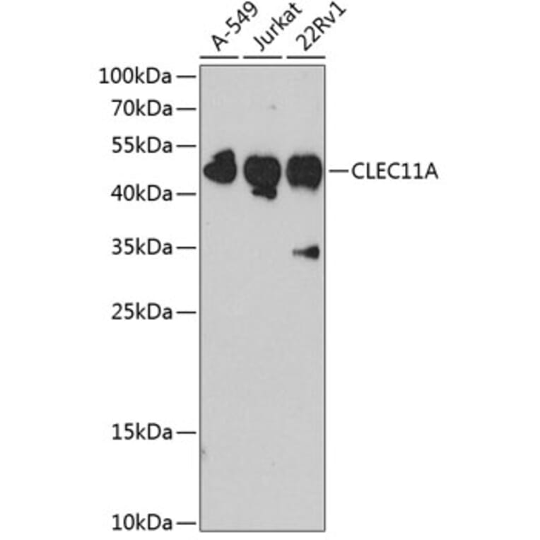 Western Blot - Anti-SCGF Antibody (A11666) - Antibodies.com