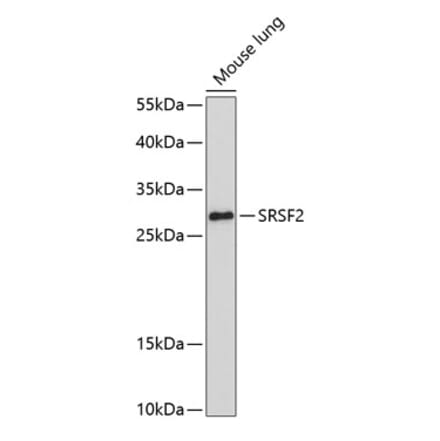 Western Blot - Anti-SC35 Antibody (A11667) - Antibodies.com