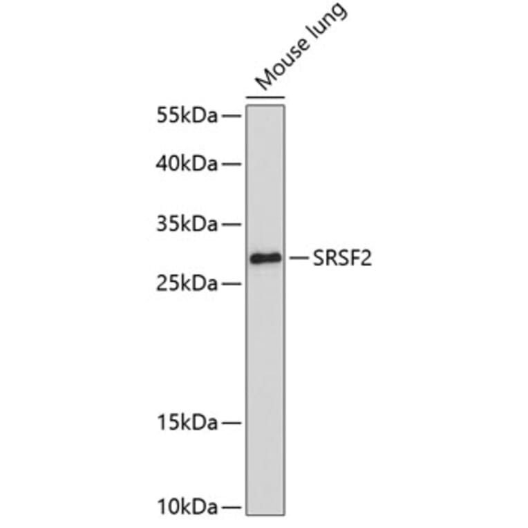 Western Blot - Anti-SC35 Antibody (A11667) - Antibodies.com