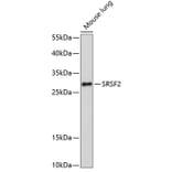 Western Blot - Anti-SC35 Antibody (A11667) - Antibodies.com