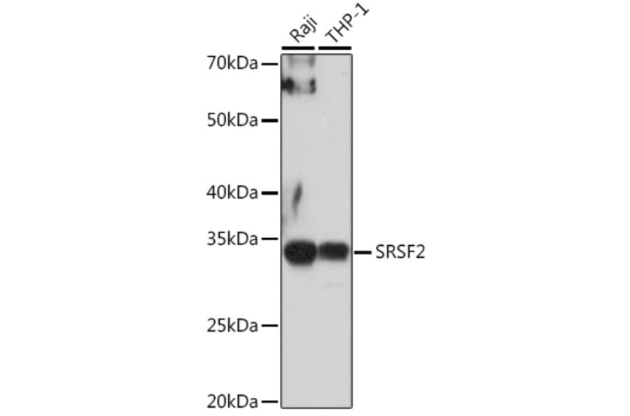 Western Blot - Anti-SC35 Antibody (A11667) - Antibodies.com