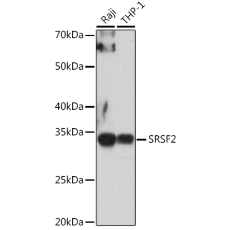 Western Blot - Anti-SC35 Antibody (A11667) - Antibodies.com