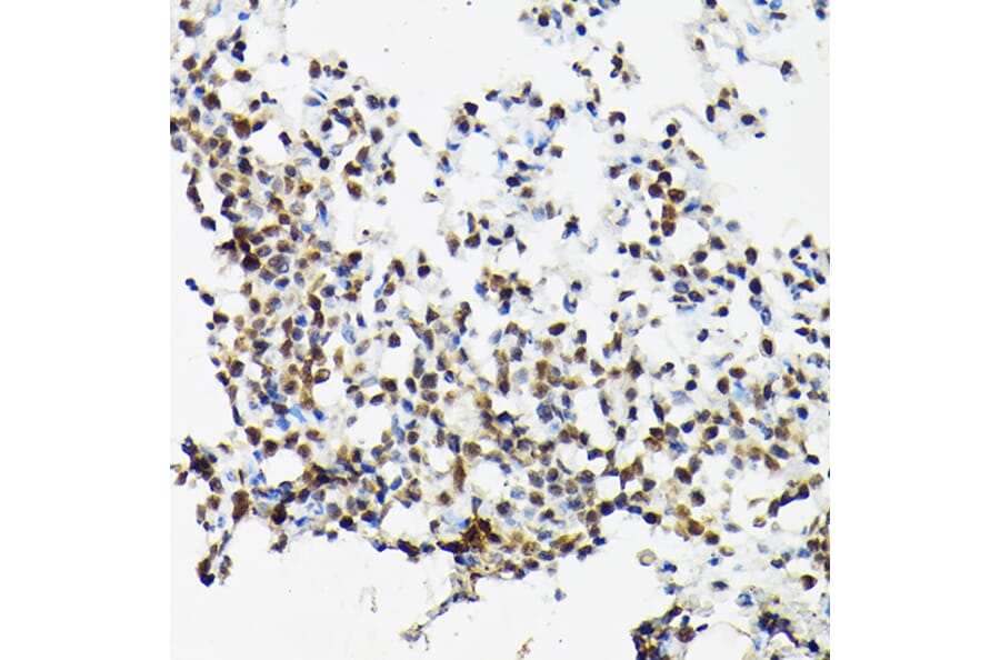 Immunohistochemistry - Anti-SC35 Antibody (A11667) - Antibodies.com