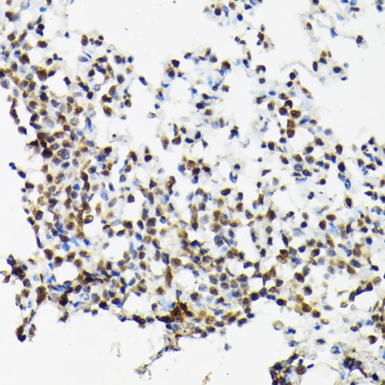 Immunohistochemistry - Anti-SC35 Antibody (A11667) - Antibodies.com