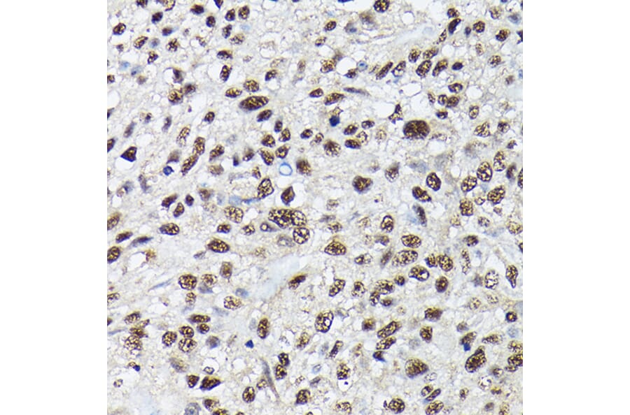 Immunohistochemistry - Anti-SC35 Antibody (A11667) - Antibodies.com
