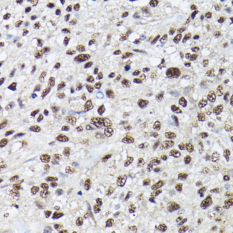 Immunohistochemistry - Anti-SC35 Antibody (A11667) - Antibodies.com